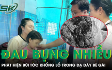Đau bụng nhiều ngày, bé gái 4 tuổi bất ngờ được bác sĩ lấy ra khỏi dạ dày búi tóc khổng lồ