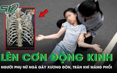 Người phụ nữ ngã gãy xương đòn, tràn máu màng phổi vì lên cơn động kinh