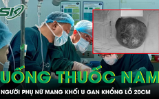 Người phụ nữ mang khối u gan khổng lồ 20cm sau thời gian tự chữa bằng thuốc nam