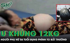 Bụng to bất thường, người phụ nữ 'khóc ngất' khi phát hiện khối u khổng lồ nặng tới 12kg 