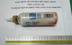 Chai nhựa dài 20cm mắc sâu trong trực tràng sau hành động tự xử của người đàn ông