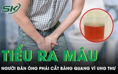 Chủ quan tiểu ra máu nhiều năm, người đàn ông phải cắt bàng quang vì ung thư