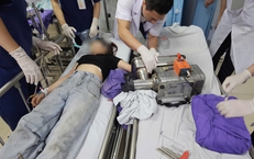 Cô gái 19 tuổi bị mất bàn tay do tai nạn trong lúc vận hành máy xay