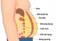 Mỡ nội tạng nguy hiểm hơn mỡ dưới da như thế nào?