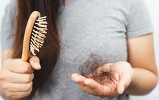 6 nhóm vi chất cần bổ sung ngay để tránh rụng tóc
