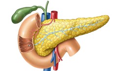Tăng mỡ máu có thể gây viêm tụy cấp nguy hiểm đến tính mạng
