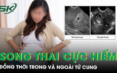 Sản phụ mang song thai cực hiếm, đồng thời trong và ngoài tử cung 