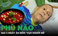 Người đàn ông phù não sau 2 ngày ăn món 'vạn người mê'