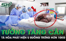 Tưởng tăng cân, nữ sinh 17 tuổi phát hiện khối u buồng trứng nặng hơn 10kg