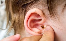Cần làm gì khi nghi ngờ trẻ bị viêm tai giữa, cách nhận biết?