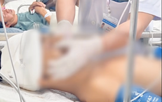 Bộ Y tế hỏa tốc chỉ đạo tập trung cứu chữa nạn nhân vụ tai nạn trên cao tốc Pháp Vân - Cầu Giẽ