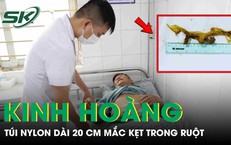Kinh hoàng: Túi nilon dài 20 cm mắc kẹt trong ruột bệnh nhân