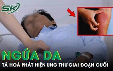 Tá hỏa phát hiện ung thư tuỵ giai đoạn cuối từ dấu hiệu ngứa da