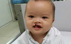 Bé trai 8 tháng tuổi bị bỏ rơi trước cổng chùa cần trợ giúp để phẫu thuật dị tật