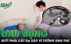Người đàn ông 42 tuổi đau bụng dữ dội, suýt phải cắt dạ dày vì tổn thương nghi ung thư