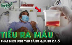 Phát hiện ung thư bàng quang đa ổ từ dấu hiệu tiểu ra máu