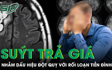 Người đàn ông suýt trả giá vì nhầm dấu hiệu đột quỵ với rối loạn tiền đình