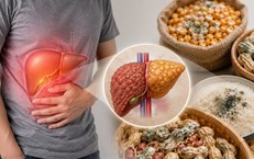 Ai có nguy cơ cao mắc bệnh xơ gan?
