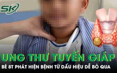 Bé trai 8 tuổi phát hiện mắc ung thư tuyến giáp từ dấu hiệu hàng triệu người bỏ qua