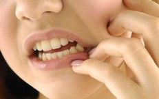 Viêm xương hàm hay bị bỏ qua do triệu chứng dễ nhầm với bệnh răng miệng thông thường