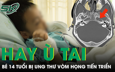 Bé trai 14 tuổi liên tục ù tai, bác sĩ phát hiện ung thư vòm mũi họng giai đoạn tiến triển