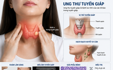 Sau mổ ung thư tuyến giáp, ai cần điều trị I-131?