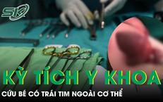 Bé trai chào đời với trái tim nằm ngoài cơ thể 