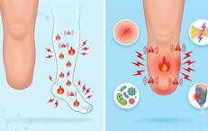 Thời tiết thay đổi có thể khiến tay chân đã cụt bị đau trở lại