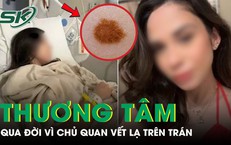 
Cô gái 26 tuổi qua đời thương tâm vì chủ quan vết lạ trên trán