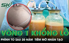 Vòng một phình khổng lồ sau 20 năm tiêm mỡ nhân tạo