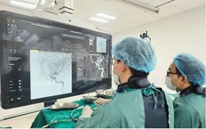 Đau đầu kéo dài cảnh giác với túi phình động mạch não nguy hiểm