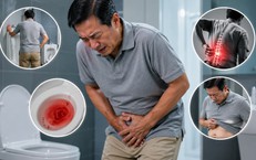 Nam giới 50 tuổi vì sao cần tầm soát ung thư tuyến tiền liệt?