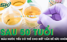 Sau tuổi 50, chỉ cần nhìn một dấu hiệu sau khi đi vệ sinh cũng có thể nhận biết sức khỏe
