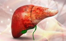 Ung thư gan có di truyền và những người thuộc nhóm nguy cơ cao