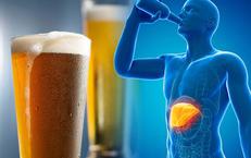 Ngoài hạn chế rượu bia, những thói quen nào giúp phòng bệnh gan hiệu quả? 