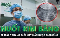 Nuốt kim băng đang bung mở bé 9 tháng tuổi may mắn được cứu sống 
