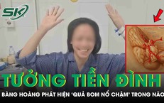 Đau đầu tưởng tiền đình, người phụ nữ bàng hoàng phát hiện “quả bom nổ chậm” trong não