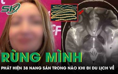 Rùng mình: Cô gái tá hỏa phát hiện 38 nang sán trong não