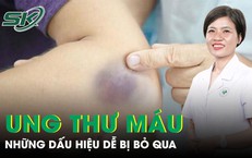 Những dấu hiệu ung thư máu dễ bị bỏ qua
