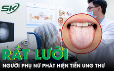 Rát lưỡi kéo dài, bất ngờ phát hiện tiền ung thư