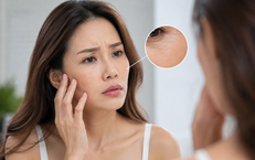 6 dấu hiệu làn da đang già đi nhanh hơn tuổi thật