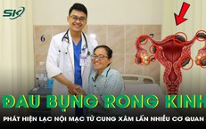 Đau bụng, rong kinh suốt 18 tháng, người phụ nữ phát hiện lạc nội mạc tử cung xâm lấn nhiều cơ quan