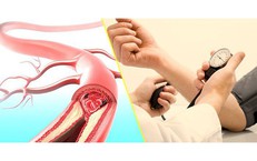 Có phải cứ chóng mặt là do cao huyết áp?