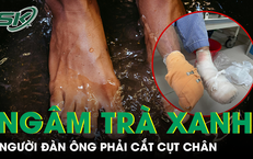 Ngâm chân nước trà xanh nóng chữa tê bì, người đàn ông phải cắt cụt chi