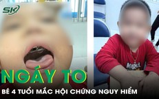 Ngáy to tưởng bình thường, bé trai 4 tuổi phát hiện mắc hội chứng nguy hiểm