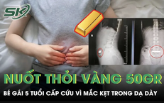 Bé gái 5 tuổi nuốt thỏi vàng 50 gram mắc kẹt trong dạ dày 