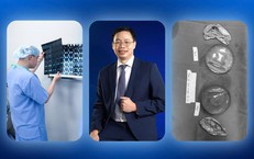 Đừng chủ quan với những dấu hiệu bao xơ khi nâng ngực