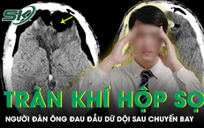 Đau đầu dữ dội sau chuyến bay, người đàn ông phát hiện tràn khí hộp sọ