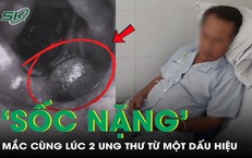 Người đàn ông 55 tuổi 'sốc nặng' khi phát hiện mắc cùng lúc 2 ung thư