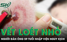 Chủ quan với vết loét không đau, người đàn ông nhập viện nguy kịch